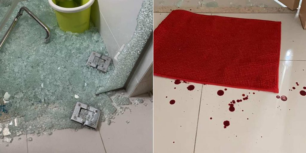 Woman Claims Shower Screen Shattered, Injuring Her Young Daughters