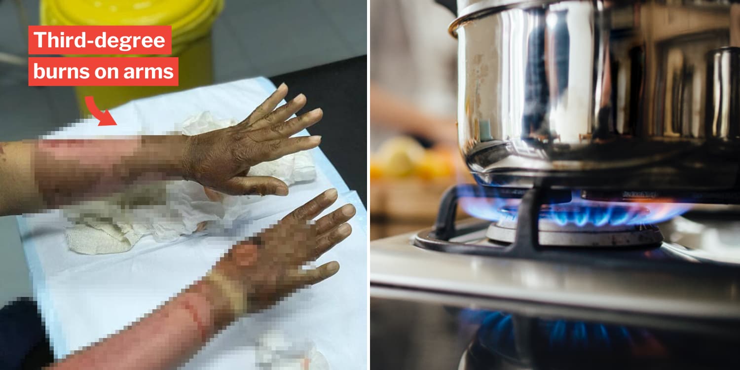 Her limbs caught fire the moment she turned on the stove. 
