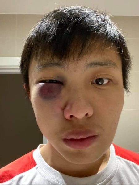 singaporean-student-london-beaten-450x600.jpg