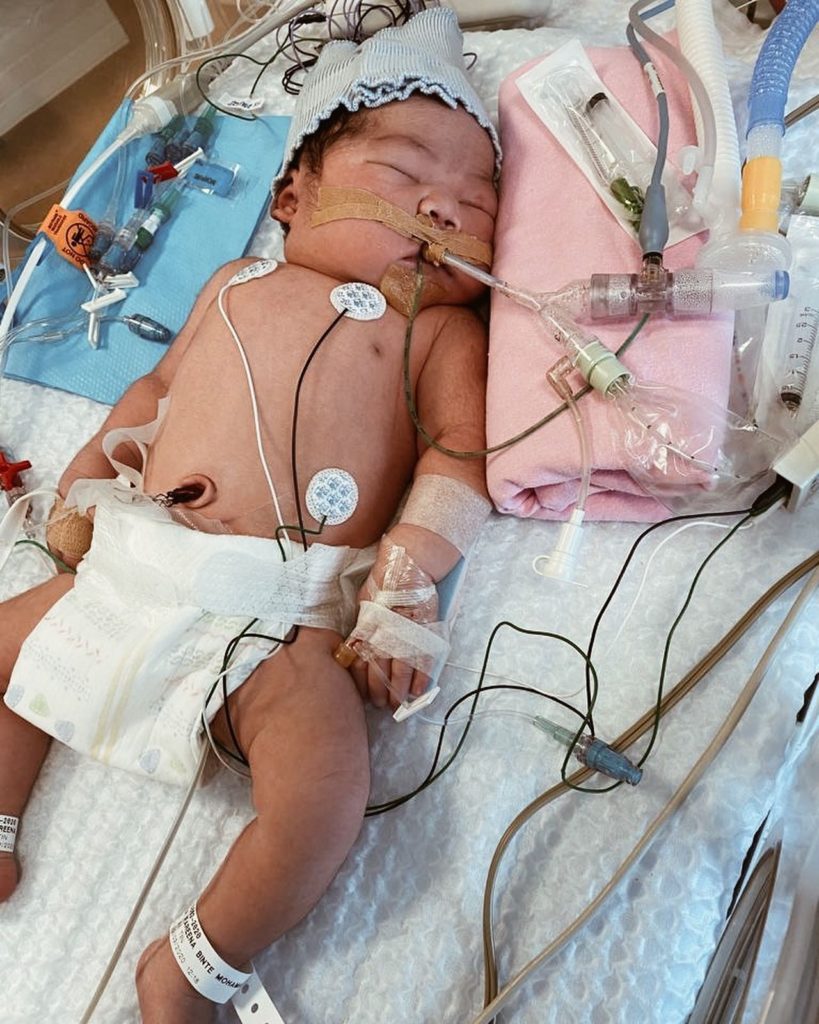 S'pore Baby Born Without Heartbeat, Mother Finally Embraces Her After 8 ...