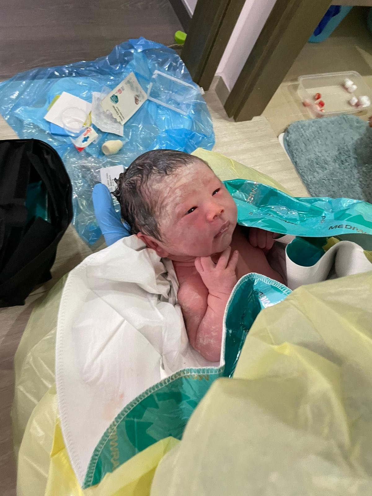 En Caul Birth: When Baby Is Born in the Amniotic Sac