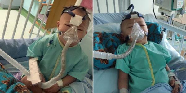 Indonesian Toddler Comes To S'pore For Leukaemia Treatment, Family Raising S$300K For Medical Fees