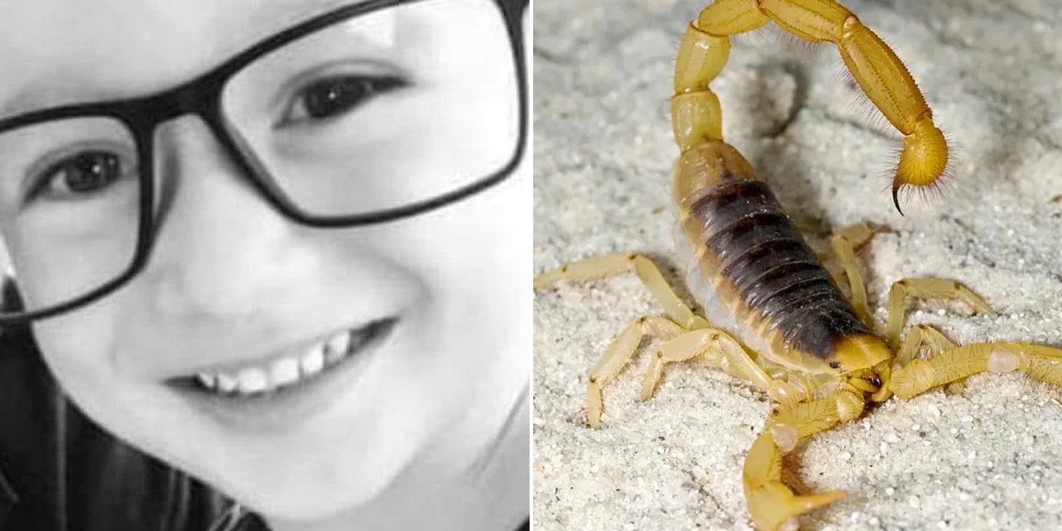 Um menino de 7 anos morreu de ataque cardíaco após ser picado por um escorpião no Brasil.