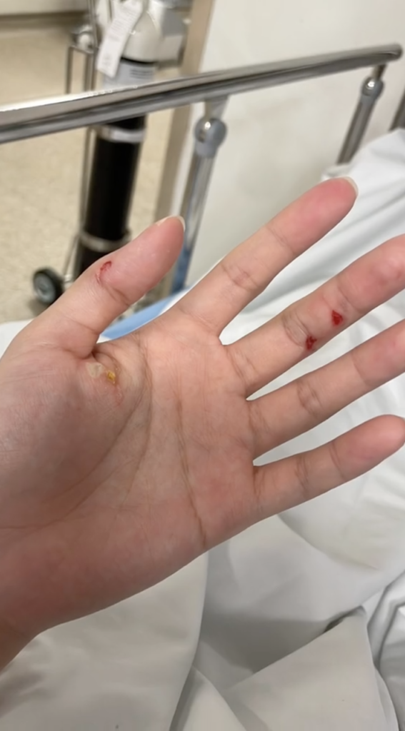 S'pore Woman Gets Electrocuted While Setting Up Fairy Lights