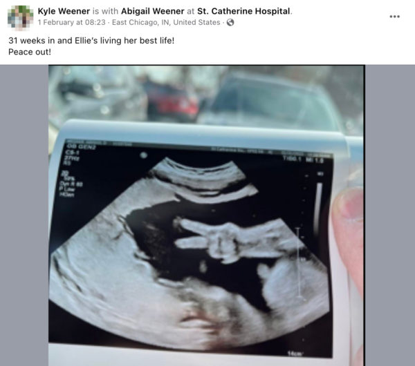 Foetus Makes 'Peace' Sign During Ultrasound In US, Medical Staff ...