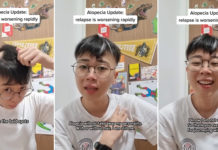 Alopecia Patient In S'pore Experiences Relapse, Wants Others With Condition To Know They Have Support