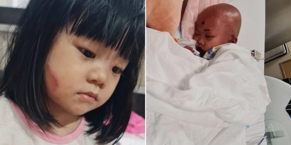4-Year-Old Girl With Rare Blood Cancer Needs S$600K For Treatment In S'pore