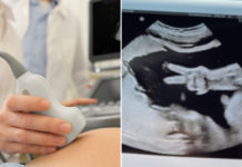 Foetus Makes 'Peace' Sign During Ultrasound In US, Medical Staff Surprised By Rare Occurrence