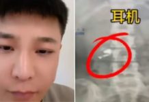 Man In China Falls Asleep With Wireless Earphones, Wakes Up With One Of Them Inside Stomach