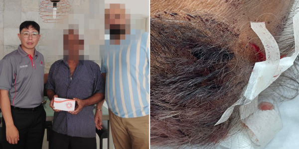 Potong Pasir Condo Security Officer Physically Assaulted By Resident, Police Report Made