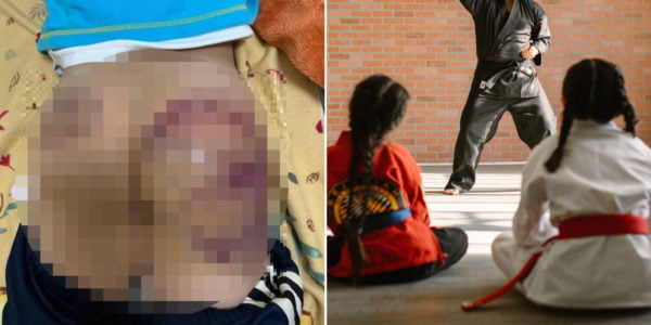 Taekwondo Teacher In Taiwan Leaves Young Student With Severe Bruises, Gets Coaching Licence Suspended