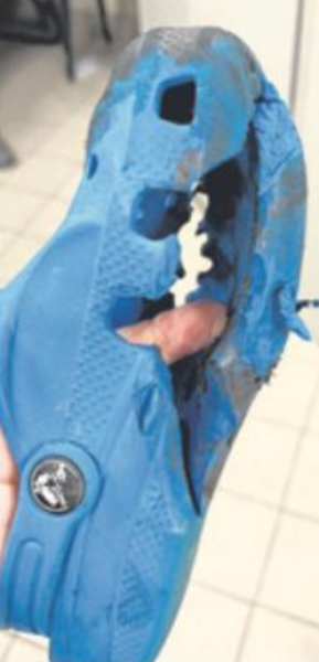 6-Year-Old Boy's Crocs Get Caught In Botanic Gardens MRT Escalator, He ...
