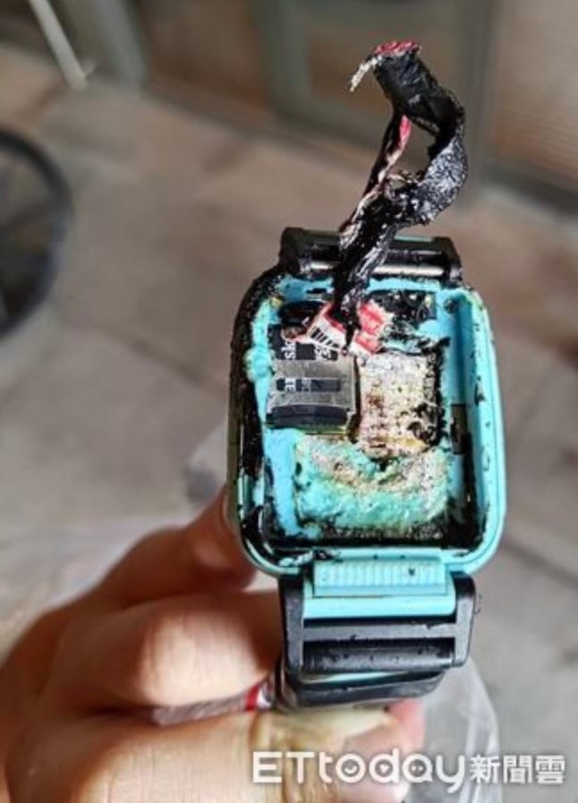 Smartwatch Explodes