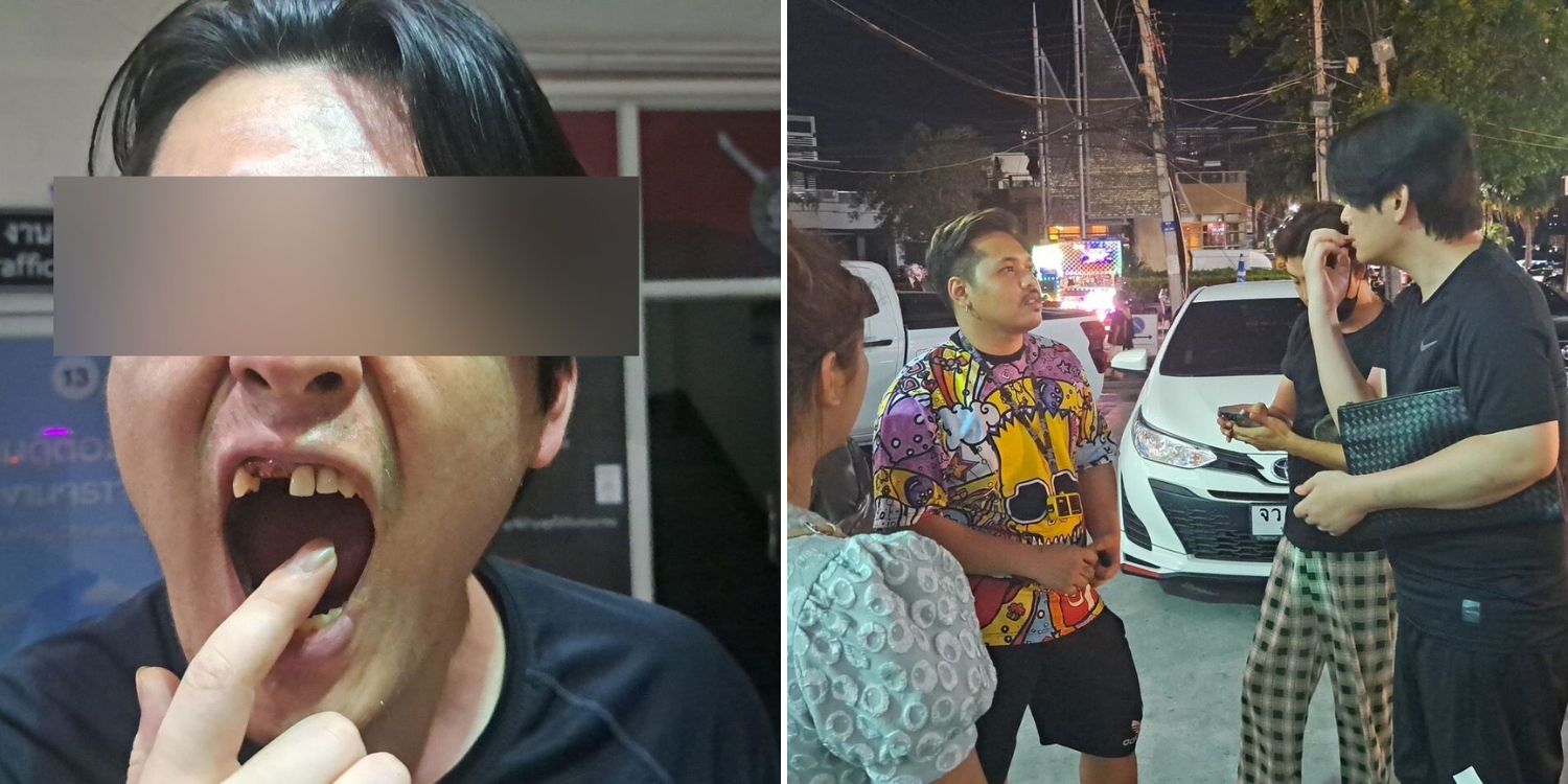 Korean man throws money at Thai animal show owner, gets 3 teeth knocked out 