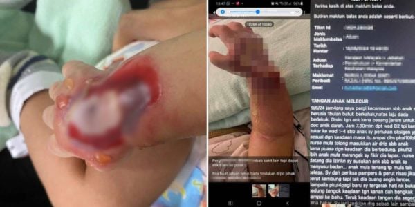 1-month-old baby scalded malaysia