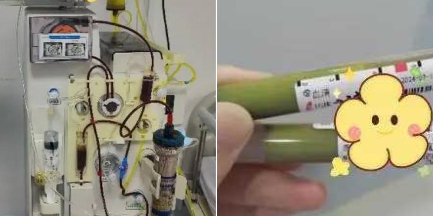 36-year-old man in China found to have green blood after drinking almost every day