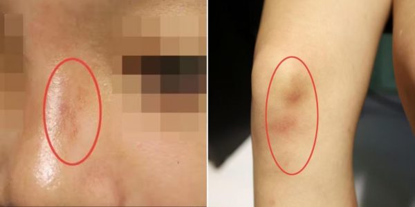 teen assaulted vaping