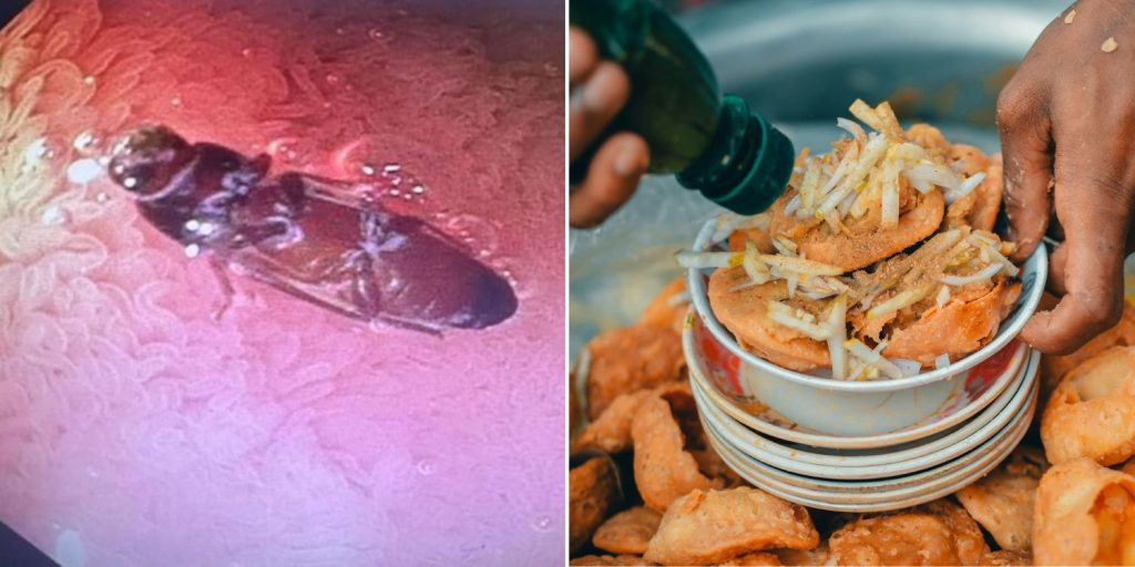 Man in India suffers stomach pains, discovers live cockroach inside