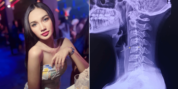 20-year-old Thai singer paralysed for a month & dies after neck-twisting massage