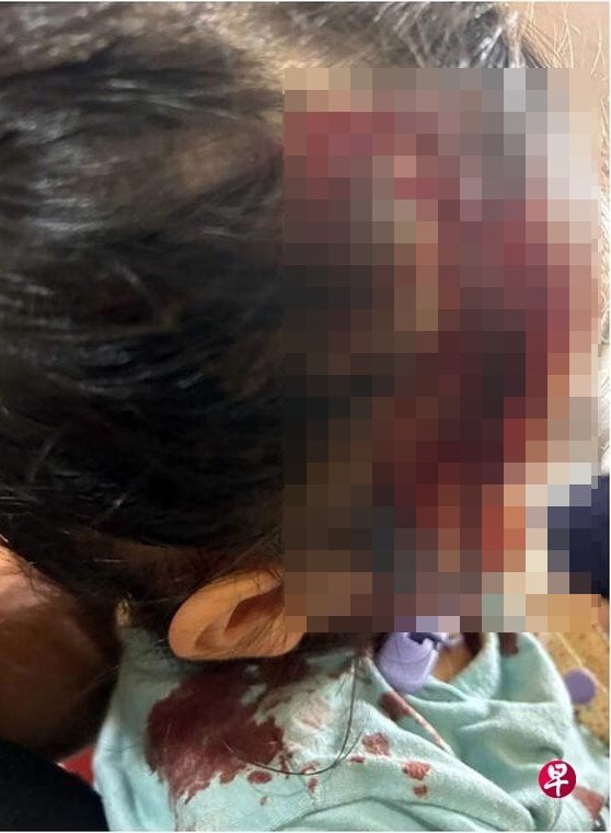 2-year-old head injury