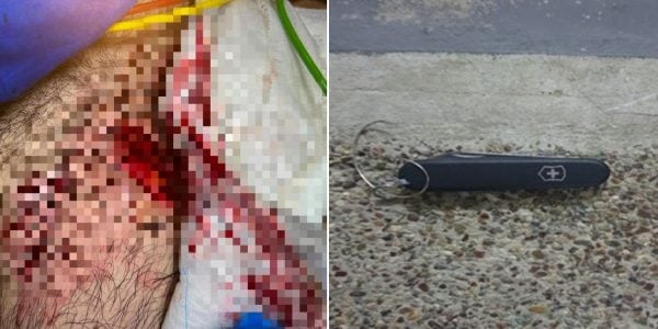 Food delivery rider allegedly stabbed in Marsiling, 21-year-old man arrested