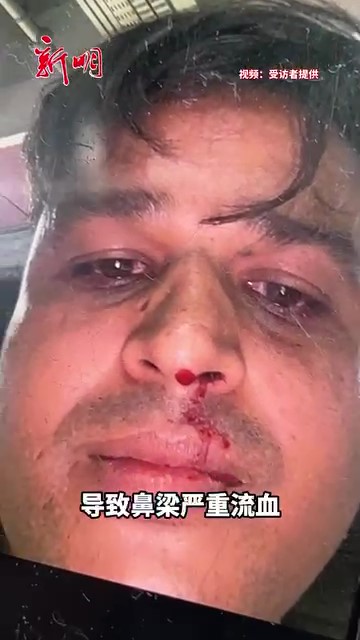 Migrant worker punched