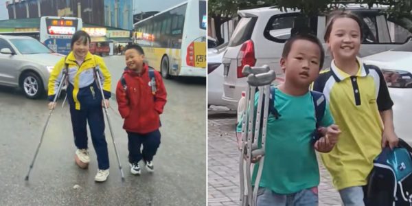 boy sister amputated leg