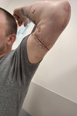 kill rescue dog mauled arm