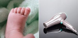 newborn-toes-amputated