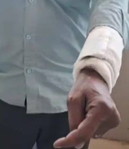 elderly man operation