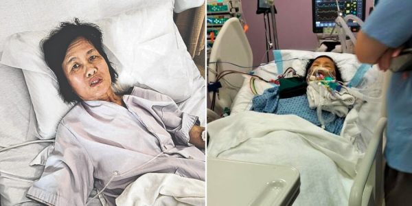 woman sudden liver failure