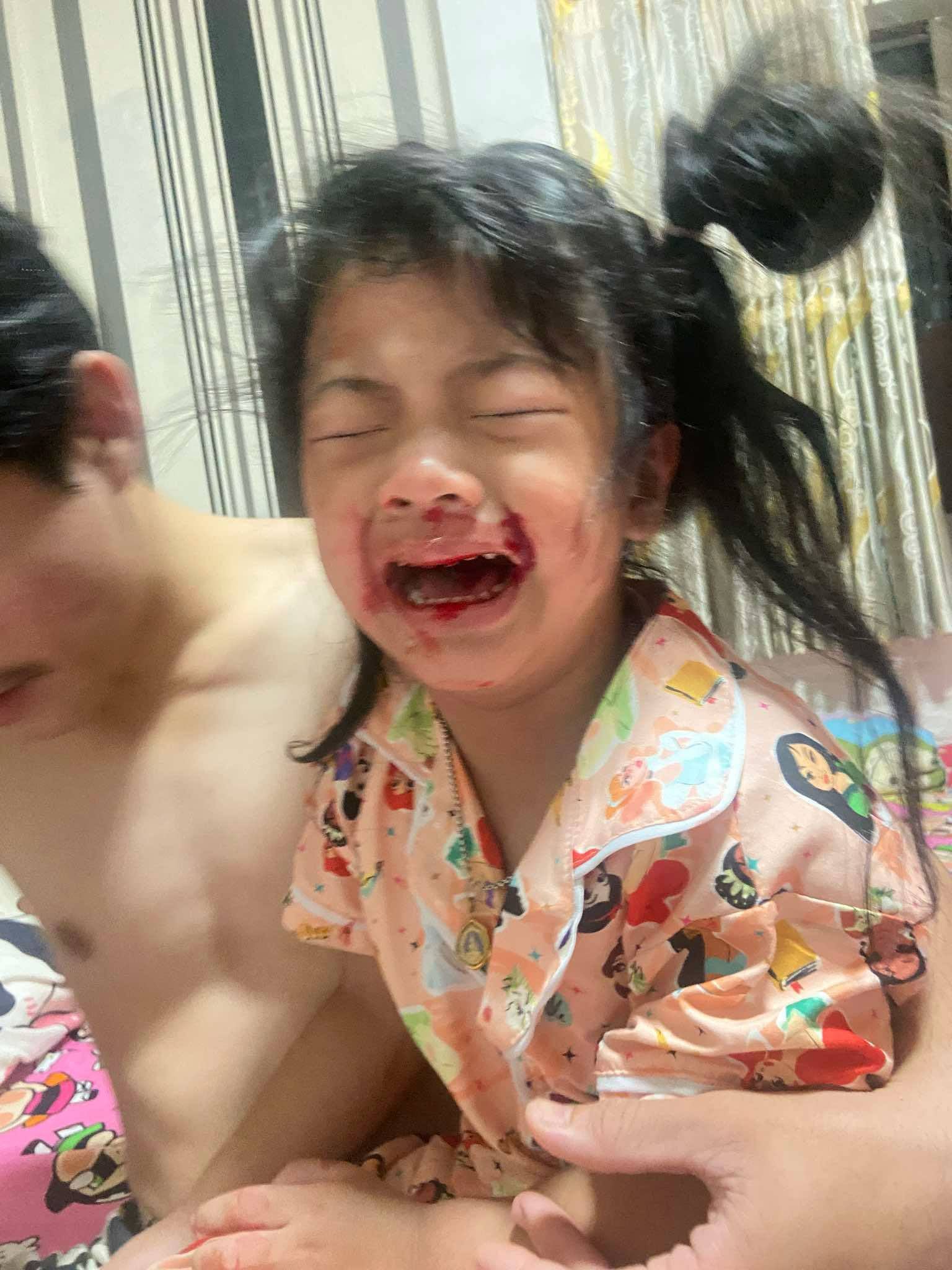 girl bitten centipede