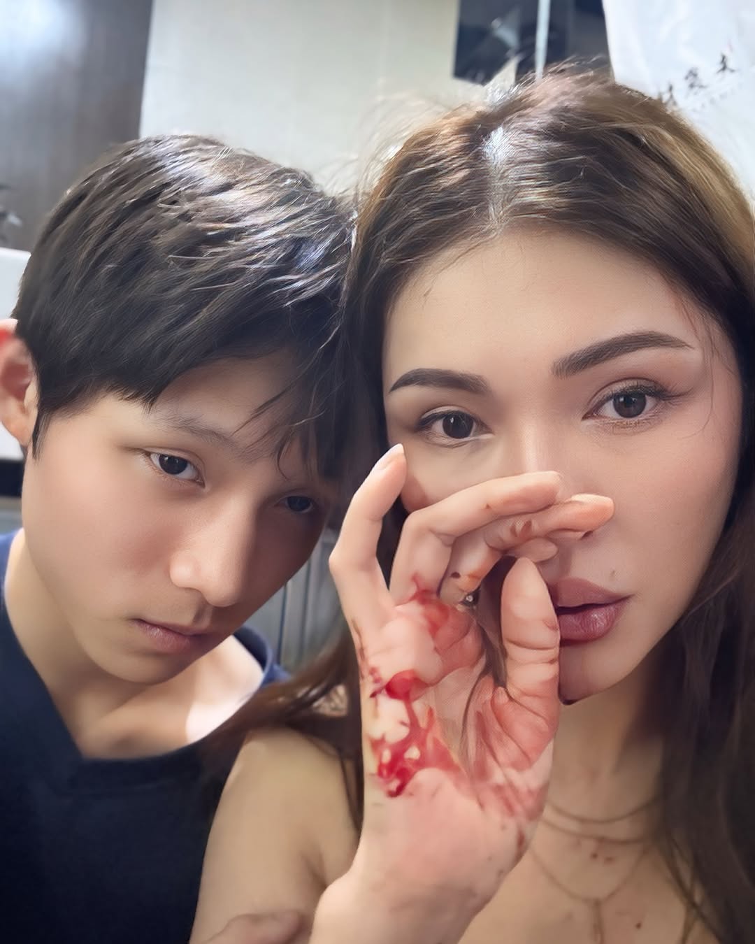 model hospitalised collapsing