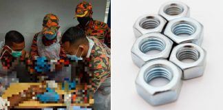 man fingers amputated