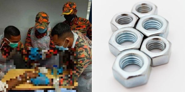 man fingers amputated