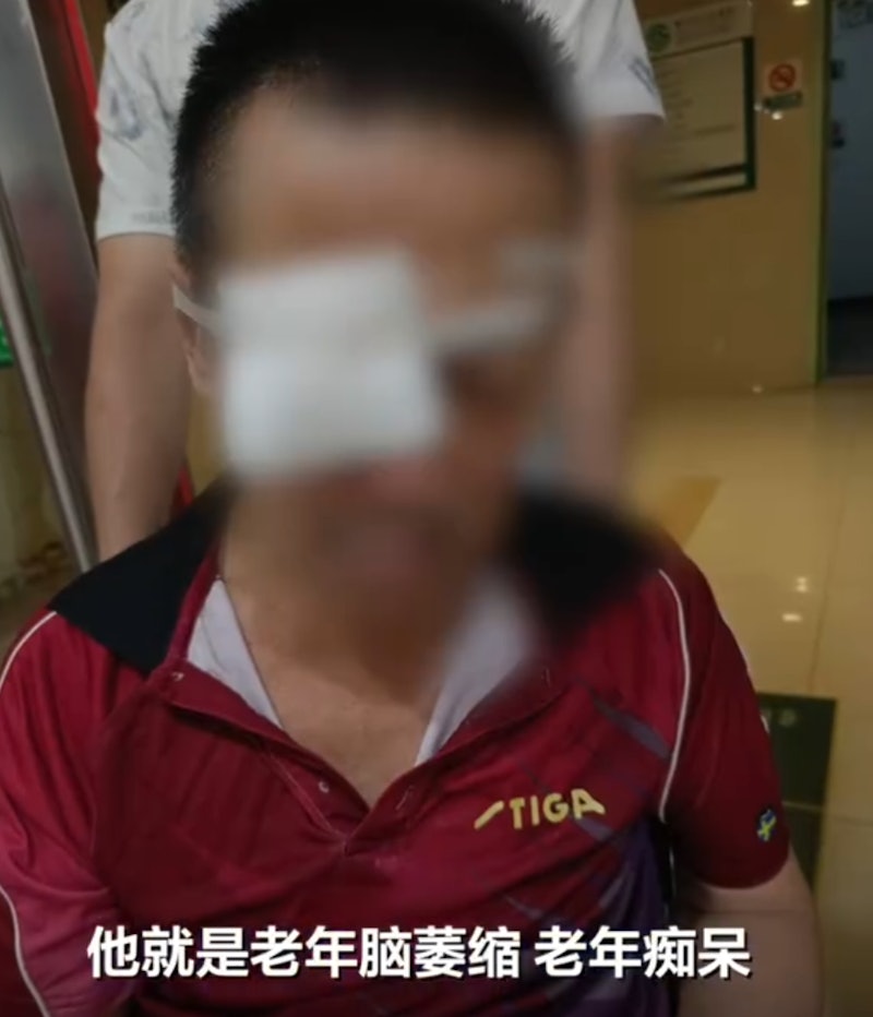 patient china eyes gouged