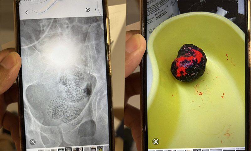 man seizure meth pills scan