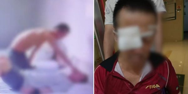 patient china eyes gouged