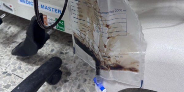 student kidney failure