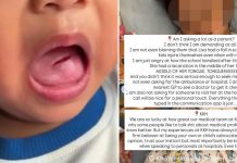 12 stitches tongue
