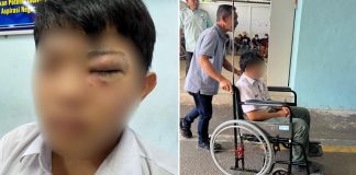 boy beaten classmates