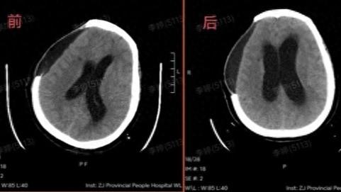 woman sunbathing china