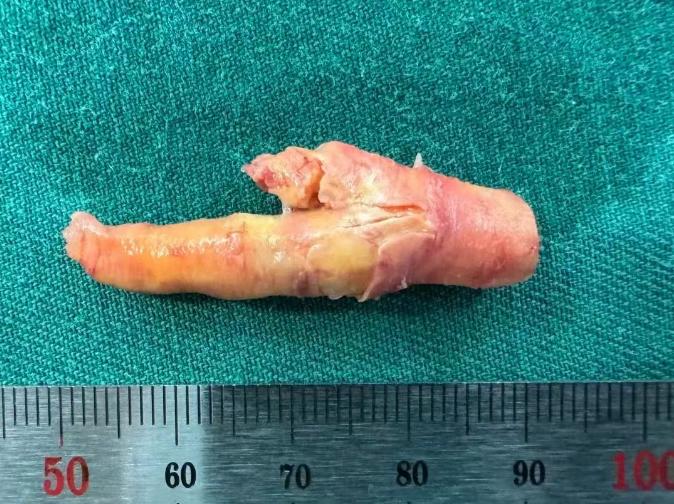 chicken foot-shaped plaque (2)