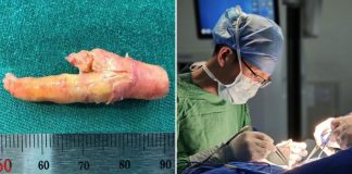 chicken foot-shaped plaque