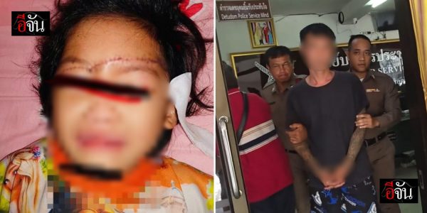 girl eyes slashed thailand
