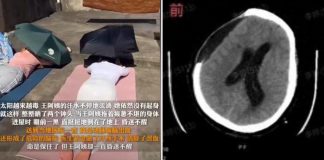 woman sunbathing china