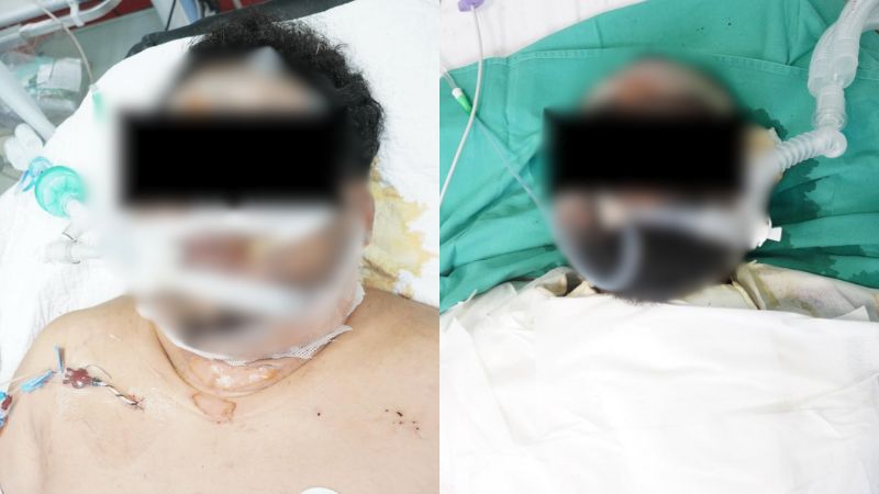 man set girlfriend fire