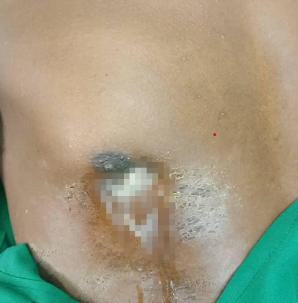 knife chest man tanzania