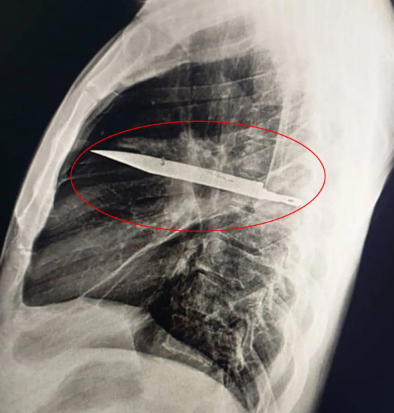 knife chest man tanzania