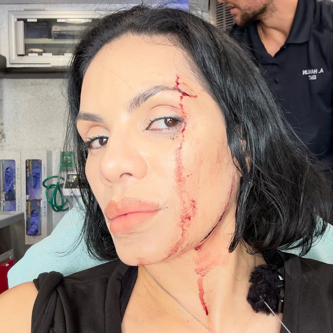 car crashes restaurant influencers injury 1